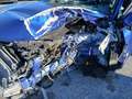 Alfa Romeo Stelvio 2.2 Turbodiesel 190 CV AT8 Q4 Sprint Blu/Azzurro - thumbnail 4