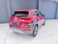 Hyundai KONA Kona I 2017 1.0 t-gdi Style 2wd 120cv Rosso - thumbnail 12