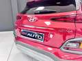Hyundai KONA Kona I 2017 1.0 t-gdi Style 2wd 120cv Rosso - thumbnail 13