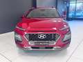 Hyundai KONA Kona I 2017 1.0 t-gdi Style 2wd 120cv Rosso - thumbnail 4