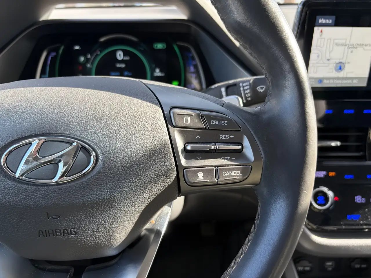 Hyundai IONIQ снимка Hyundai IONIQ