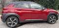 Hyundai KONA 1.0 t-gdi Style 2wd 120cv - thumbnail 2