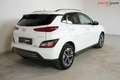 Hyundai KONA Trend | DYNAMIK | 64kWh | Abstandstemp. | HuD Weiß - thumbnail 5