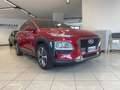 Hyundai KONA 1.0 t-gdi Xpossible 2wd 120cv - thumbnail 1