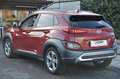 Hyundai KONA Kona 1.0 t-gdi Xline 2wd 120cv Rosso - thumbnail 2