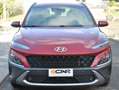 Hyundai KONA Kona 1.0 t-gdi Xline 2wd 120cv Rosso - thumbnail 5