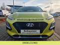 Hyundai KONA Trend 2WD Gelb - thumbnail 4
