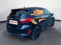 Ford Fiesta Fiesta 1.0 ecoboost h X 125cv Nero - thumbnail 4