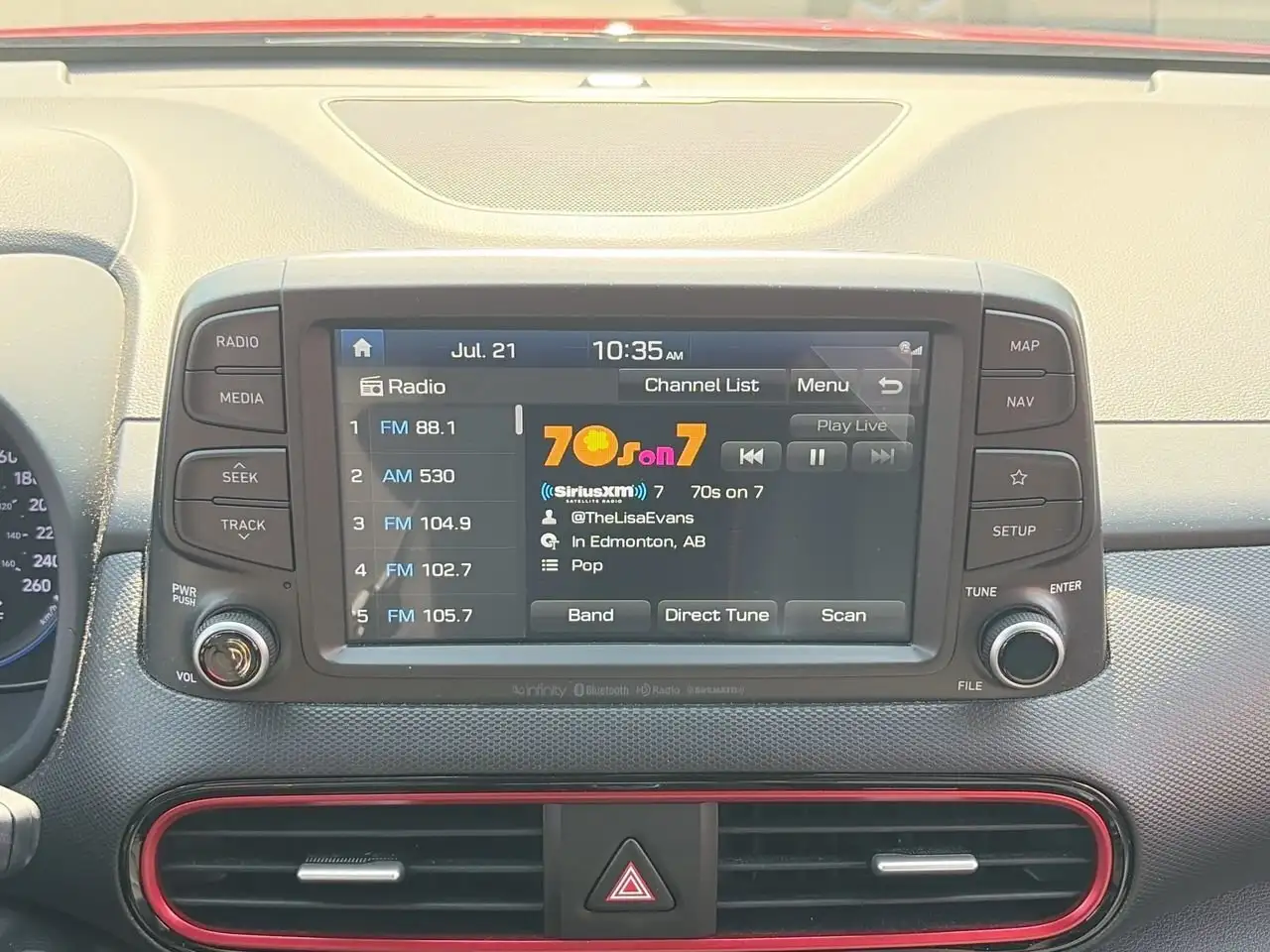 Hyundai KONA снимка Hyundai KONA