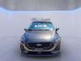 Ford Fiesta 1.0 Ecoboost Hybrid 125 CV 5 porte ST-Line Grigio - thumbnail 2