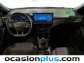 Ford Focus 1.0 Ecoboost MHEV ST-Line 125 Bleu - thumbnail 6