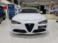 Alfa Romeo Giulia 2.2 Turbo Diesel 150CV AT8 Tech Edition Nero - thumbnail 2