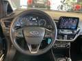 Ford Fiesta 1.1 75 CV 5 porte Titanium Grigio - thumbnail 9