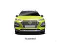 Hyundai KONA 1.0 T-GDI Trend/DAB/SHZ/LenkradHZG/RFK/GRA Blu/Azzurro - thumbnail 4