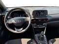 Hyundai KONA 1.6 CRDI 115 CV XPrime Rosso - thumbnail 10
