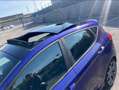Ford Fiesta 5p 1.5 tdci ST-Line 120cv Blu/Azzurro - thumbnail 3