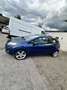 Ford Fiesta Trend 1,6 TDCi DPF - thumbnail 5