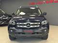 Mercedes-Benz X 250 X 250 d Power 4matic auto Blu/Azzurro - thumbnail 2
