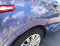 Peugeot 208 208 I 2012 5p 1.4 hdi 8v Active Blu/Azzurro - thumbnail 7