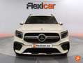 Mercedes-Benz GLB 200 2.0++200+D+DCT+110KW+%28150CV%29 Blanco - thumbnail 1