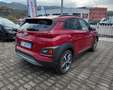 Hyundai KONA Kona 1.6 crdi Xpossible 2wd 115cv Rot - thumbnail 5
