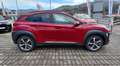 Hyundai KONA Kona 1.6 crdi Xpossible 2wd 115cv Rot - thumbnail 6