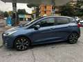 Ford Fiesta Fiesta 5p 1.5 tdci ST-Line 85cv Blau - thumbnail 2