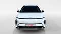 Hyundai KONA EV 204CV 65KWH TECNO 2C - thumbnail 6