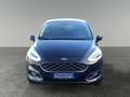 Ford Fiesta Vignale Schwarz - thumbnail 8