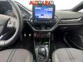 Ford Fiesta Fiesta 1.5 Ecoboost 200 CV 5 porte ST Noir - thumbnail 5