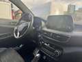 Hyundai TUCSON 1.6 CRDi Hybrid 48V - 136 - BV DCT-7 S&S Evap 2015 N Line Edition PHASE 2 Grau - thumbnail 9