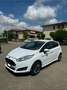 Ford Fiesta 5p 1.5 tdci ST-line 75cv - thumbnail 2