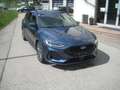 Ford Focus ST-Line X - 125PS, Garantie, Neues Modell Blau - thumbnail 5