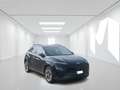 Hyundai KONA 64 kWh EV Xline - GM723MB TASSO 0 ANTICIPO 0 Nero - thumbnail 1