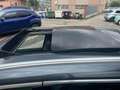 BMW X1 sDrive18d xLine Plus Grigio - thumbnail 6