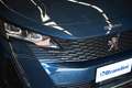 Peugeot 5008 1.5 BlueHDi Allure Pack Blu/Azzurro - thumbnail 4