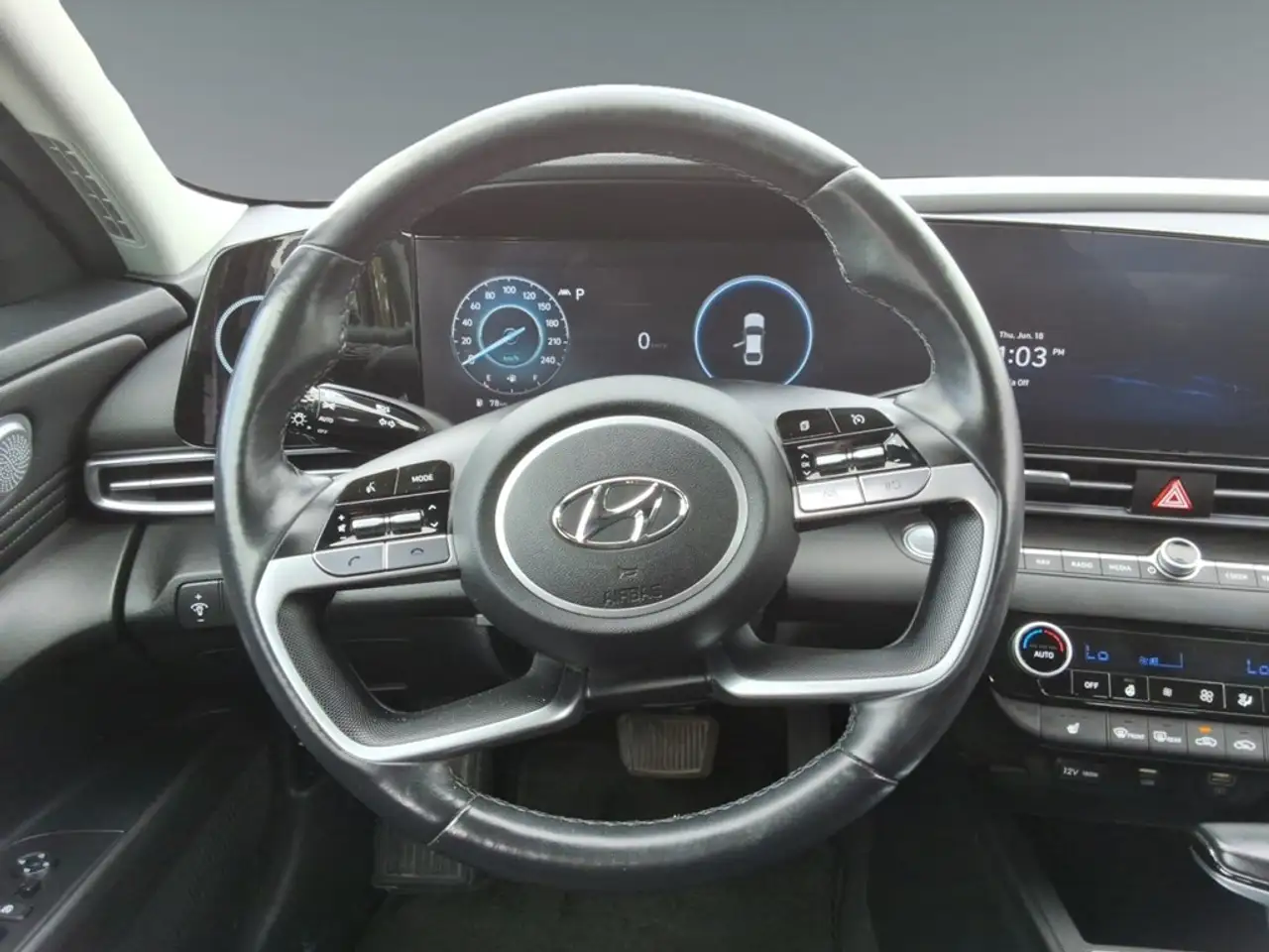 Hyundai ELANTRA photo Hyundai ELANTRA