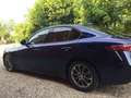 Alfa Romeo Giulia Giulia 2.2 t Business 136cv auto - thumbnail 4