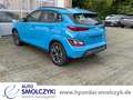 Hyundai KONA 64kWH  SELECT-PAKET APPLECARPLAY+KAMERA+BT Blu/Azzurro - thumbnail 4