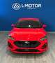 Ford Focus 1.0 Ecoboost MHEV 92kW ST-Line - thumbnail 3