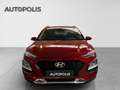 Hyundai KONA 1.6 Techno Diesel Rouge - thumbnail 3