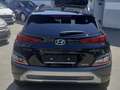 Hyundai KONA Kona 1.6 gdi hev Xline 2wd 141cv  PAGA COME VUOI Black - thumbnail 5