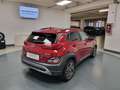Hyundai KONA 1.6 gdi hev Xline 2wd 141cv dct Bronzo - thumbnail 8