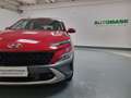 Hyundai KONA 1.6 gdi hev Xline 2wd 141cv dct Bronzo - thumbnail 17