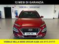 Hyundai KONA 1.600 DIESEL 136 CV X-PRIME + SAFETY PACK 4WD Rosso - thumbnail 2