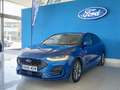 Ford Focus 1.0 Ecoboost MHEV ST-Line Style SIP 125 Blauw - thumbnail 1