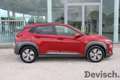 Hyundai KONA 39,2 kWh Twist TechnoPack - thumbnail 5