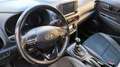 Hyundai KONA Kona 1.0 t-gdi Xpossible 2wd 120cv my18 Rosso - thumbnail 8