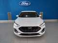 Ford Focus 1.0 Ecoboost MHEV ST-Line X 125 Beyaz - thumbnail 2