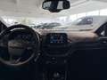 Ford Fiesta Trend 1,1 Start/Stop Blau - thumbnail 3